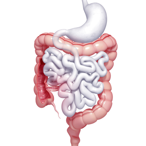 Síndrome intestino cólon irritavel